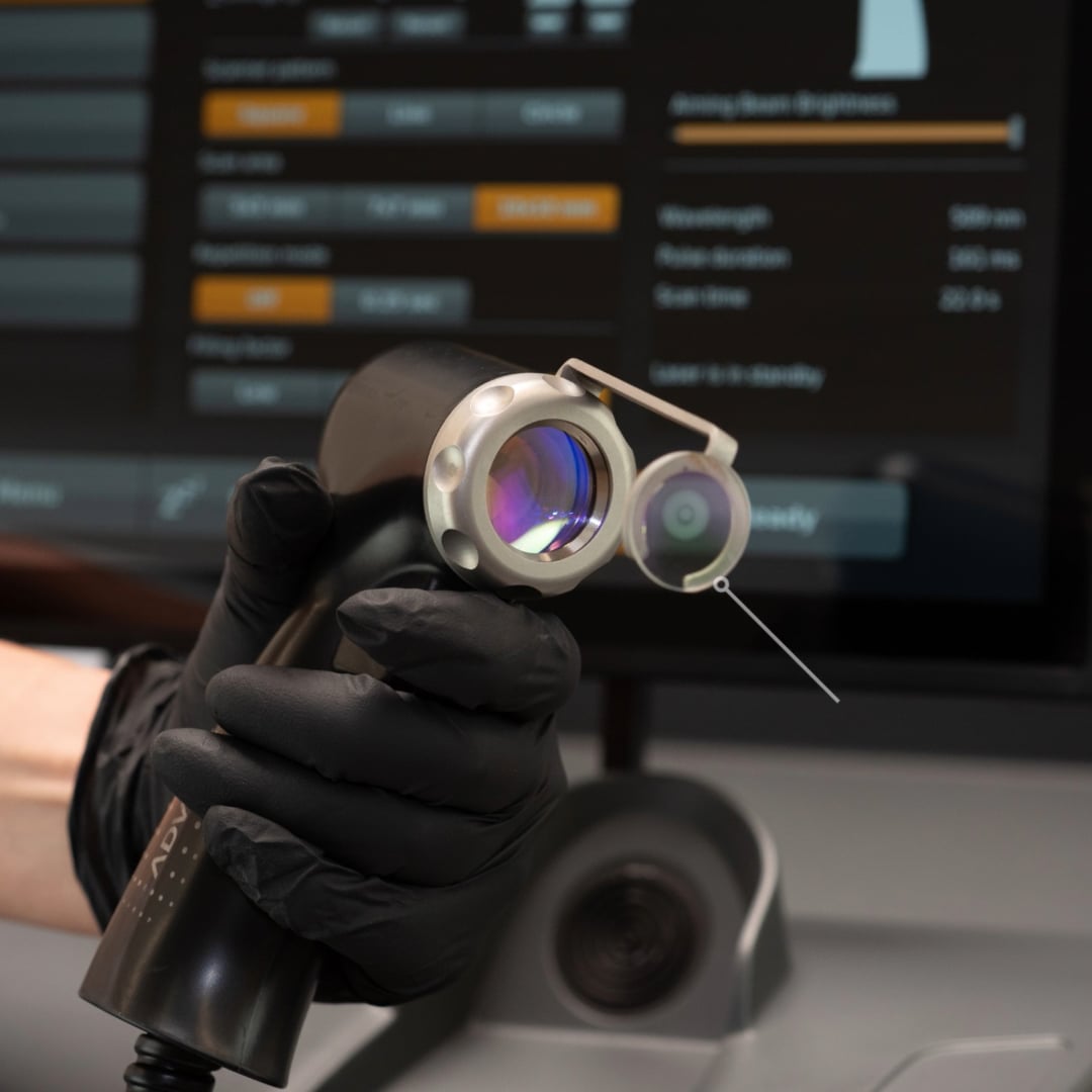 AdvaTx Passive Cooling