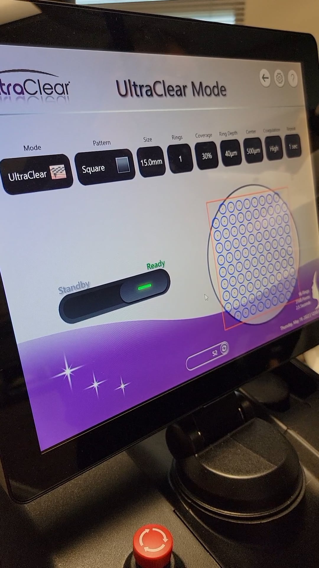 Dr. Biesman Under Eye